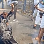 അറുപതുകാരിയുടെ ഇടത് കാലിന് പകരം വലത് കാലിൽ ശസ്ത്രക്രിയ നടത്തി, ഡോക്ടർ പോലും അറിയുന്നത് ബോധം വന്ന രോഗി പറഞ്ഞപ്പോൾ ; സംഭവം കോഴിക്കോട്ട്